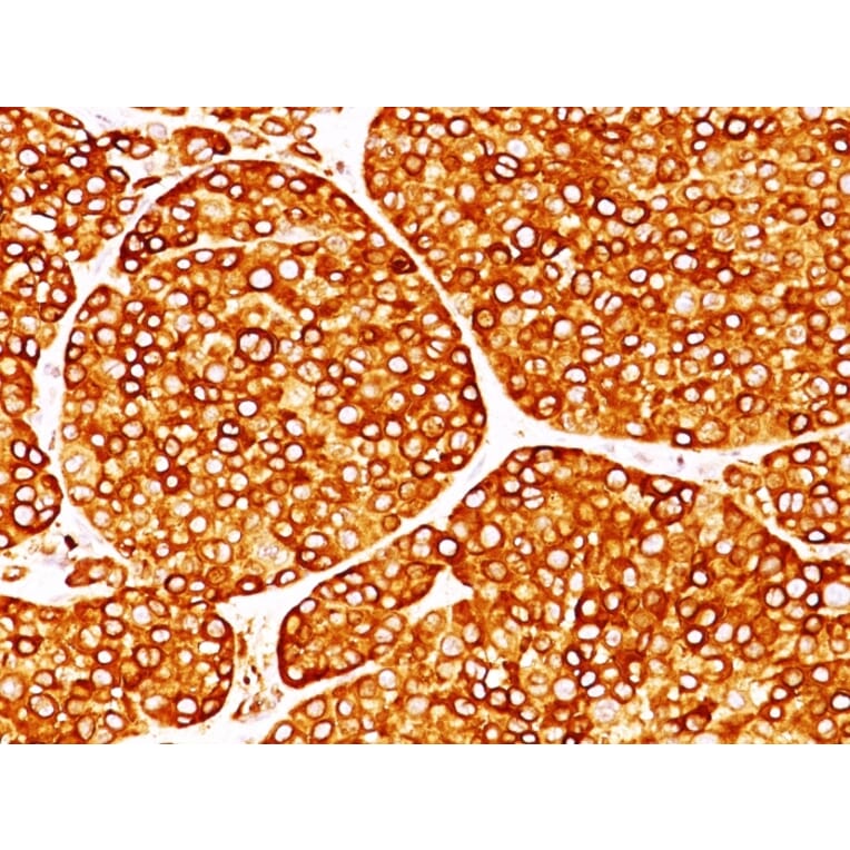 Immunohistochemistry - Anti-Tyrosinase Antibody [T311] (A250238) - Antibodies.com