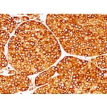 Immunohistochemistry - Anti-Tyrosinase Antibody [T311] (A250238) - Antibodies.com