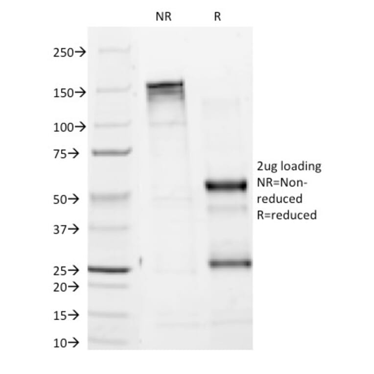 SDS-PAGE - Anti-Tyrosinase Antibody [T311] (A250239) - Antibodies.com