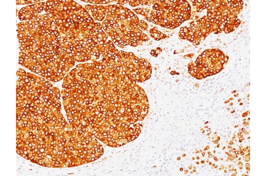 Immunohistochemistry - Anti-Tyrosinase Antibody [SPM360] (A250239) - Antibodies.com