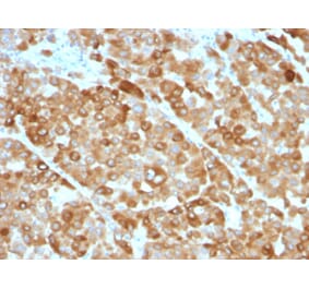 Immunohistochemistry - Anti-Tyrosinase Antibody [OCA1/812] (A250240) - Antibodies.com