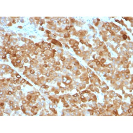 Immunohistochemistry - Anti-Tyrosinase Antibody [OCA1/812] (A250240) - Antibodies.com