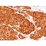 Immunohistochemistry - Anti-Tyrosinase Antibody [T311 + OCA1/812] (A250242) - Antibodies.com