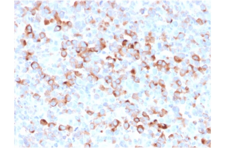 Immunohistochemistry - Anti-Tyrosinase Antibody [rOCA1/812] (A250242) - Antibodies.com