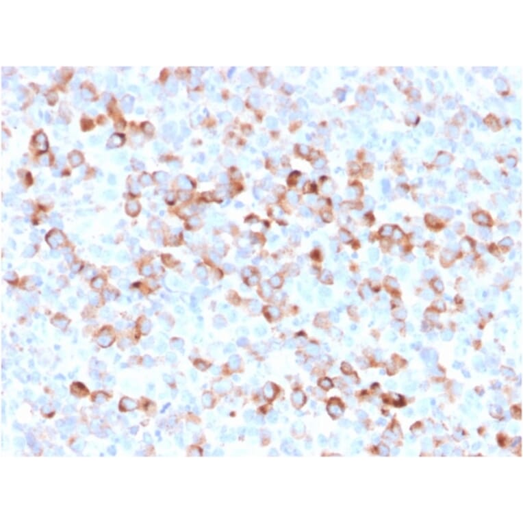 Immunohistochemistry - Anti-Tyrosinase Antibody [rOCA1/812] (A250242) - Antibodies.com