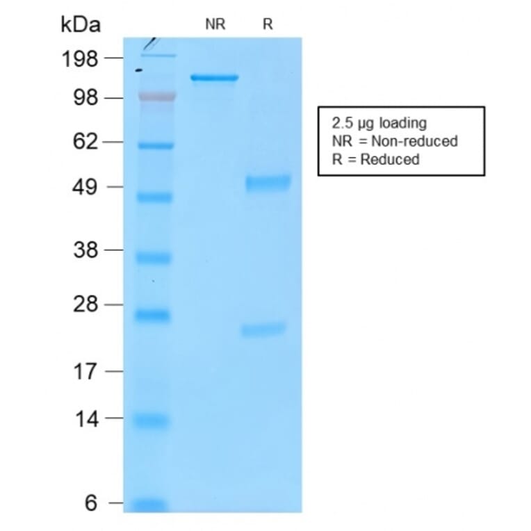 SDS-PAGE - Anti-Tyrosinase Antibody [rOCA1/812] (A250243) - Antibodies.com