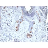 Immunohistochemistry - Anti-Tyrosinase Antibody [TYR/3829] (A250244) - Antibodies.com