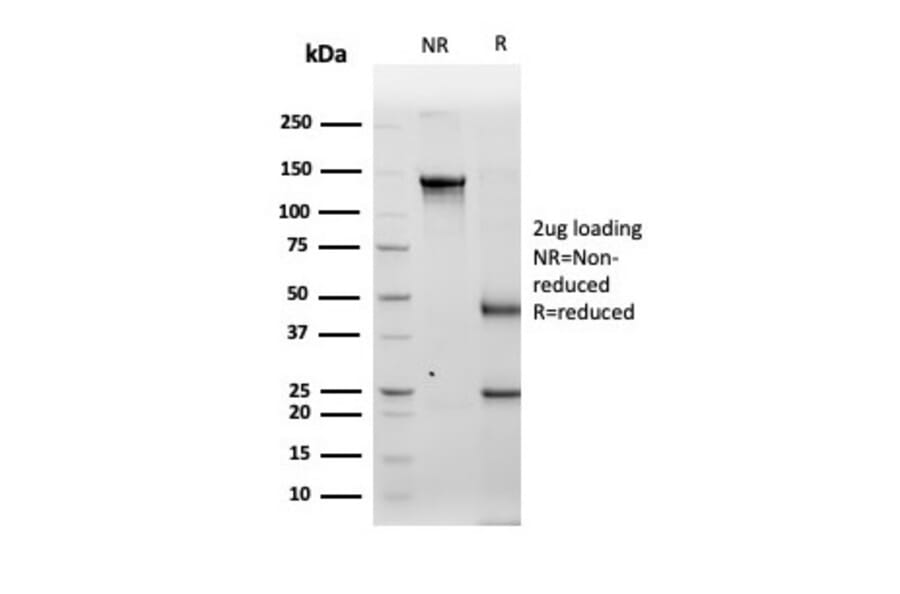 SDS-PAGE - Anti-Tyrosinase Antibody [TYR/3829] (A250244) - Antibodies.com