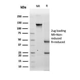 SDS-PAGE - Anti-Tyrosinase Antibody [TYR/3829] (A250244) - Antibodies.com