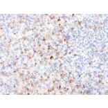 Immunohistochemistry - Anti-Tyrosinase Antibody [TYR/2024R] (A250244) - Antibodies.com