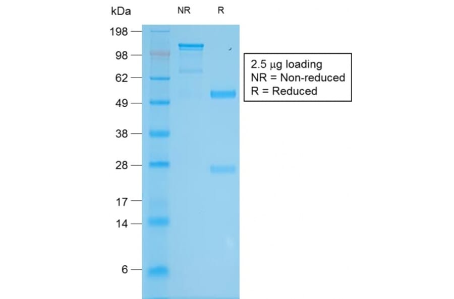 SDS-PAGE - Anti-Tyrosinase Antibody [TYR/2024R] (A250245) - Antibodies.com