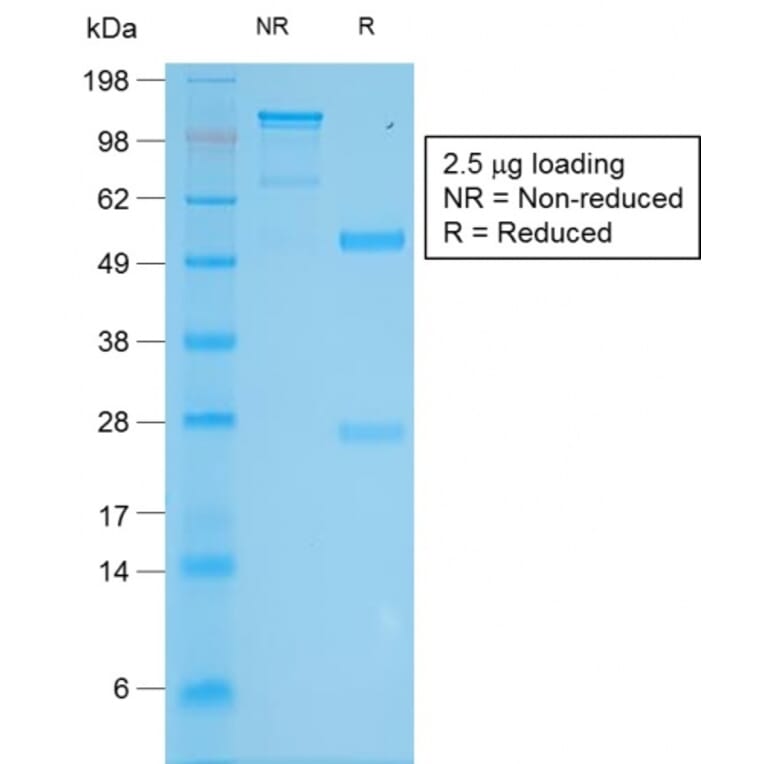 SDS-PAGE - Anti-Tyrosinase Antibody [TYR/2024R] (A250245) - Antibodies.com