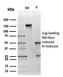 SDS-PAGE analysis of Anti-GTF2H2C Antibody [PCRP-GTF2H2C-2C9] under non-reduced and reduced conditions; showing intact IgG and intact heavy and light chains, respectively. SDS-PAGE analysis confirms the integrity and purity of the antibody.