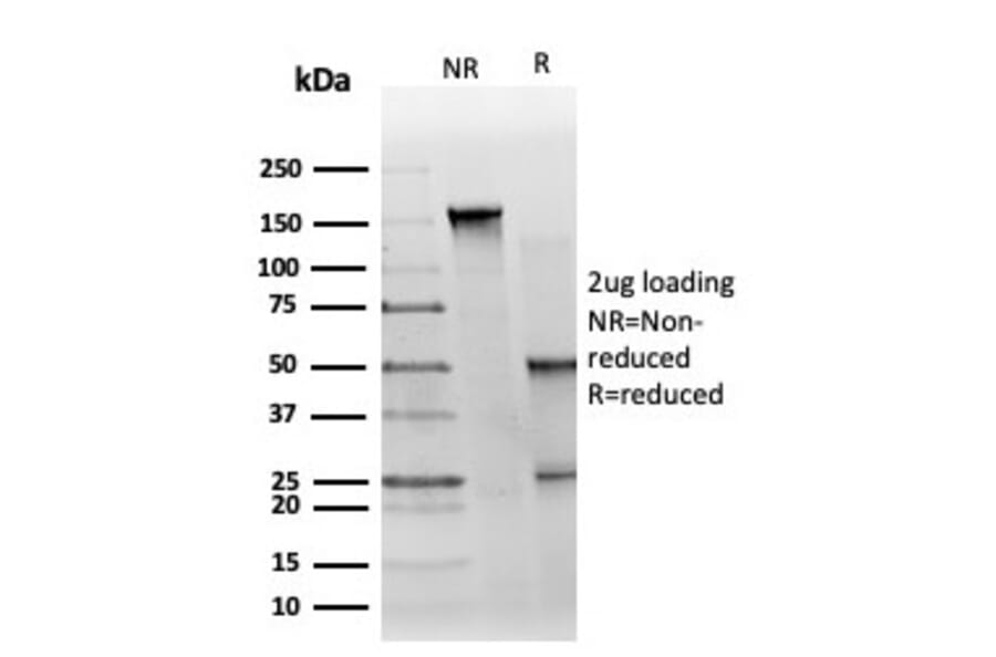 SDS-PAGE - Anti-GTF2H2C Antibody [PCRP-GTF2H2C-2C9] (A250246) - Antibodies.com