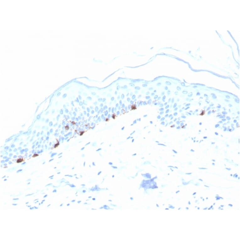 Immunohistochemistry - Anti-TRP1 Antibody [TYRP1/3280] (A250247) - Antibodies.com