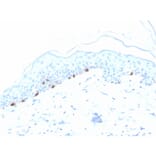 Immunohistochemistry - Anti-TRP1 Antibody [TYRP1/3280] (A250247) - Antibodies.com