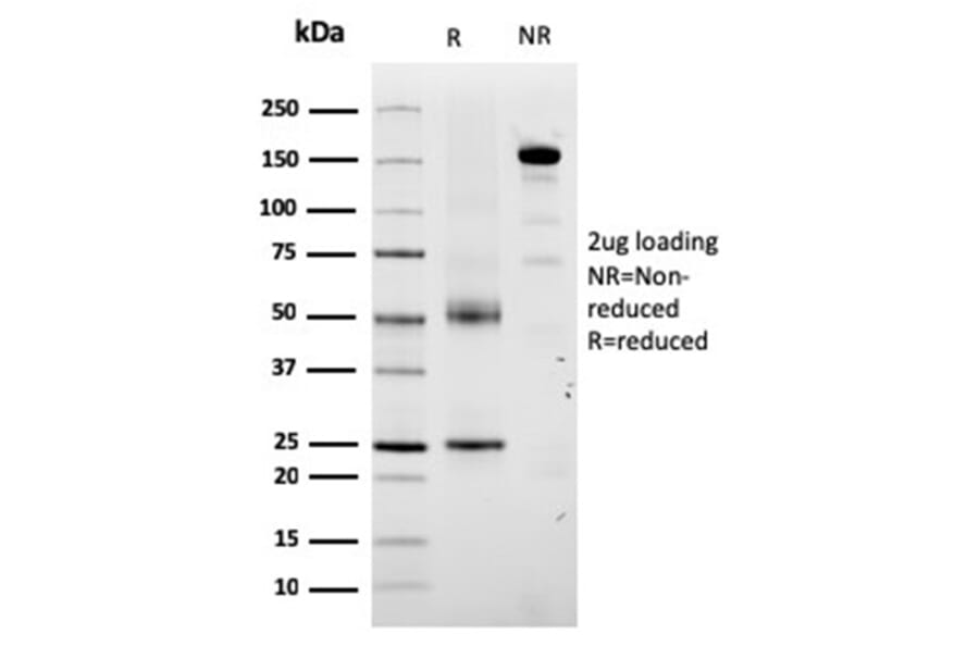 SDS-PAGE - Anti-TRP1 Antibody [TYRP1/3280] (A250247) - Antibodies.com