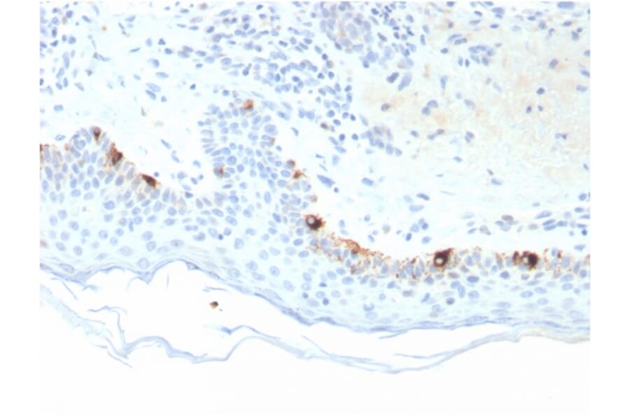 Immunohistochemistry - Anti-TRP1 Antibody [TYRP1/3281] (A250248) - Antibodies.com
