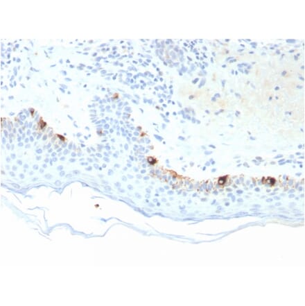 Immunohistochemistry - Anti-TRP1 Antibody [TYRP1/3281] (A250248) - Antibodies.com