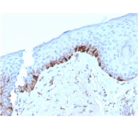 Immunohistochemistry - Anti-TRP1 Antibody [TYRP1/3282] (A250249) - Antibodies.com