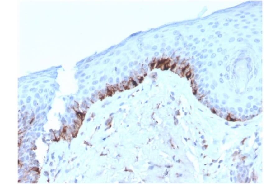 Immunohistochemistry - Anti-TRP1 Antibody [TYRP1/3282] (A250249) - Antibodies.com