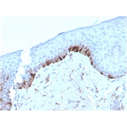 Immunohistochemistry - Anti-TRP1 Antibody [TYRP1/3282] (A250249) - Antibodies.com