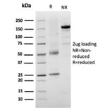 SDS-PAGE - Anti-TRP1 Antibody [TYRP1/3282] (A250249) - Antibodies.com