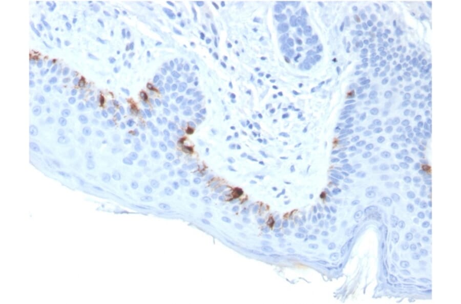Immunohistochemistry - Anti-TRP1 Antibody [TYRP1/3283] (A250250) - Antibodies.com
