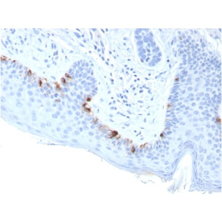 Immunohistochemistry - Anti-TRP1 Antibody [TYRP1/3283] (A250250) - Antibodies.com