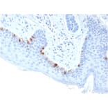 Immunohistochemistry - Anti-TRP1 Antibody [TYRP1/3283] (A250250) - Antibodies.com