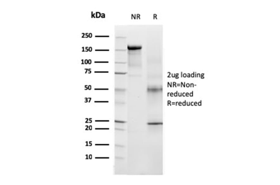 SDS-PAGE - Anti-TRP1 Antibody [TYRP1/3283] (A250250) - Antibodies.com