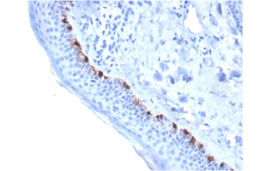 Immunohistochemistry - Anti-TRP1 Antibody [TYRP1/3284] (A250251) - Antibodies.com