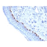 Immunohistochemistry - Anti-TRP1 Antibody [TYRP1/3284] (A250251) - Antibodies.com