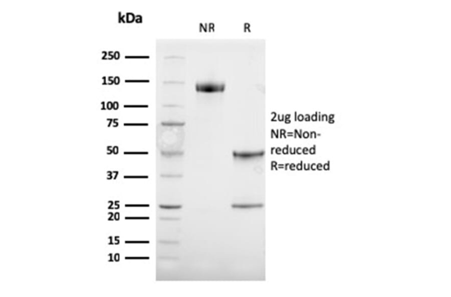 SDS-PAGE - Anti-TRP1 Antibody [TYRP1/3284] (A250251) - Antibodies.com