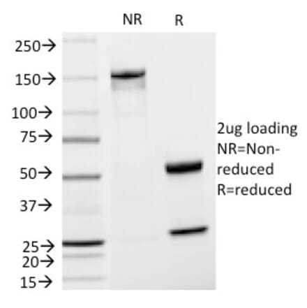 SDS-PAGE - Anti-TRP1 Antibody [TA99] (A250251) - Antibodies.com