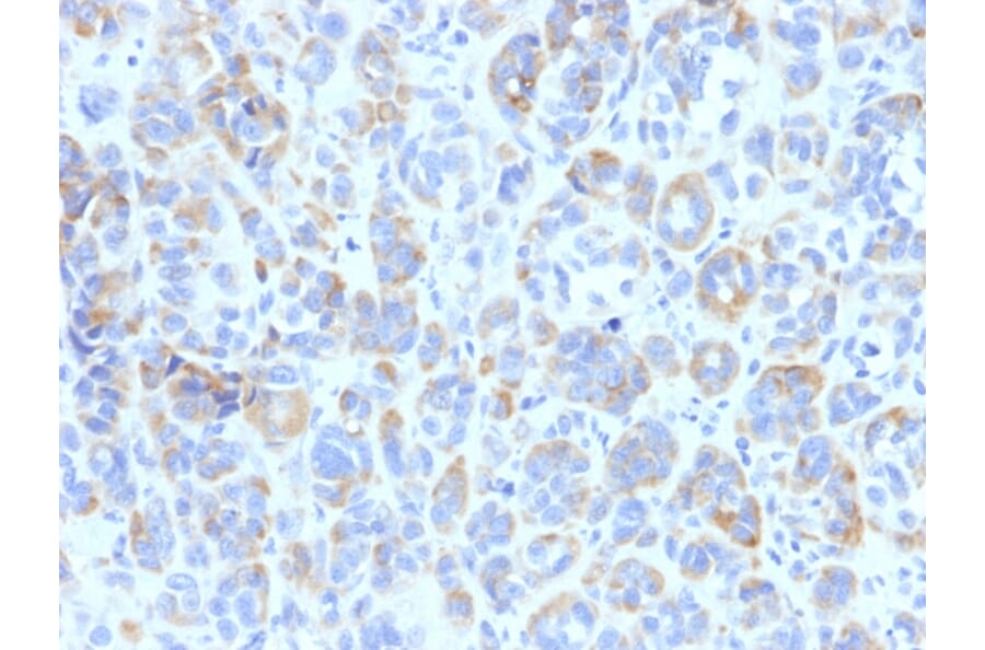 Immunohistochemistry - Anti-TRP1 Antibody [TYRP1/807] (A250252) - Antibodies.com