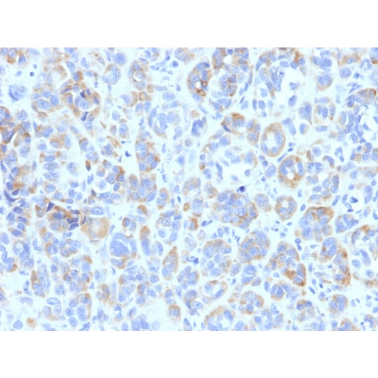 Immunohistochemistry - Anti-TRP1 Antibody [TYRP1/807] (A250252) - Antibodies.com
