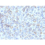 Immunohistochemistry - Anti-TRP1 Antibody [TYRP1/807] (A250252) - Antibodies.com