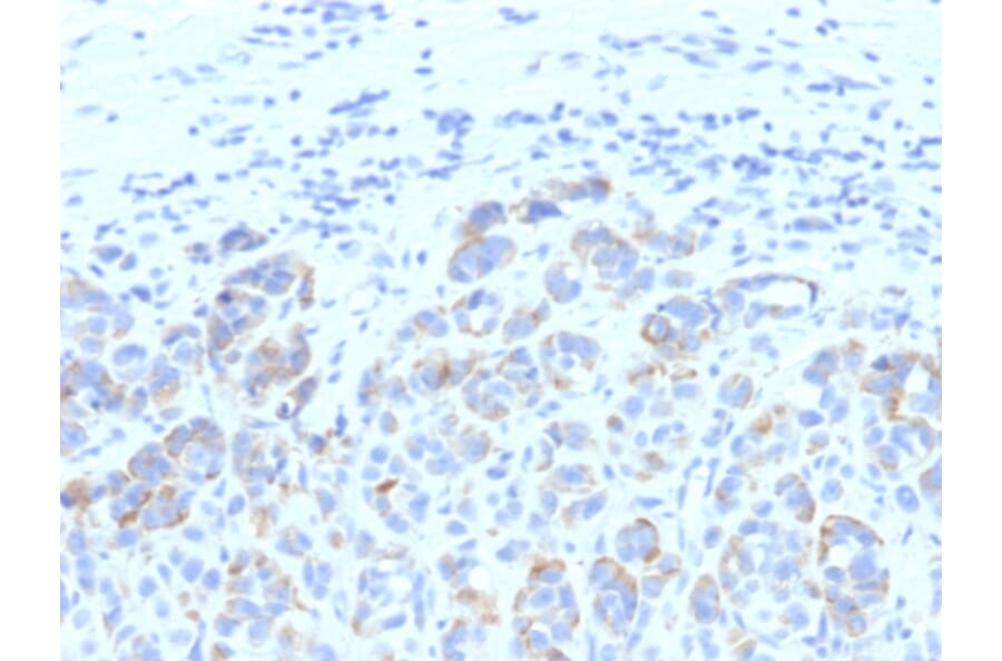 Immunohistochemistry - Anti-TRP1 Antibody [SPM611] (A250254) - Antibodies.com