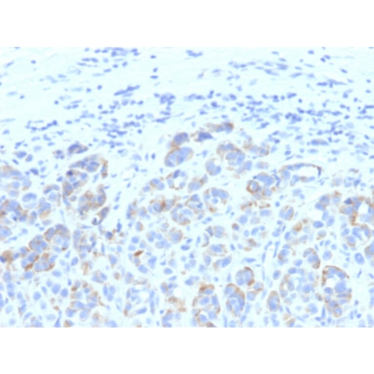 Immunohistochemistry - Anti-TRP1 Antibody [SPM611] (A250254) - Antibodies.com