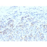 Immunohistochemistry - Anti-TRP1 Antibody [SPM611] (A250254) - Antibodies.com