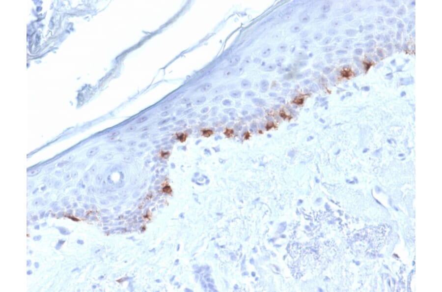 Immunohistochemistry - Anti-TRP1 Antibody [TYRP1/1986] (A250257) - Antibodies.com