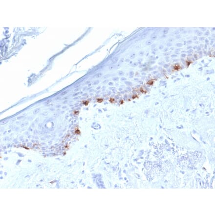 Immunohistochemistry - Anti-TRP1 Antibody [TYRP1/1986] (A250257) - Antibodies.com