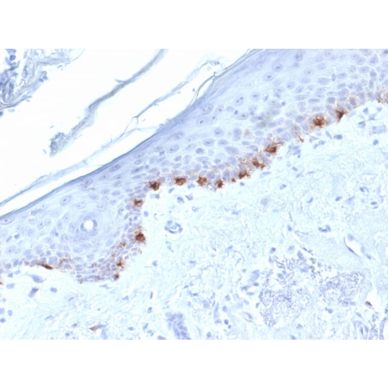 Immunohistochemistry - Anti-TRP1 Antibody [TYRP1/1986] (A250257) - Antibodies.com