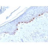 Immunohistochemistry - Anti-TRP1 Antibody [TYRP1/1986] (A250257) - Antibodies.com