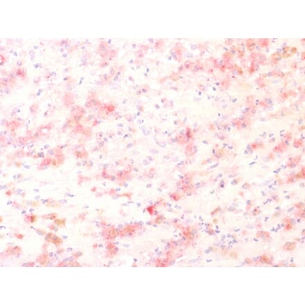 Immunohistochemistry - Anti-TRP1 Antibody [TYRP1/1564R] (A250257) - Antibodies.com