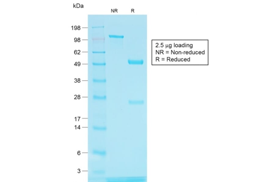 SDS-PAGE - Anti-TRP1 Antibody [TYRP1/1564R] (A250258) - Antibodies.com