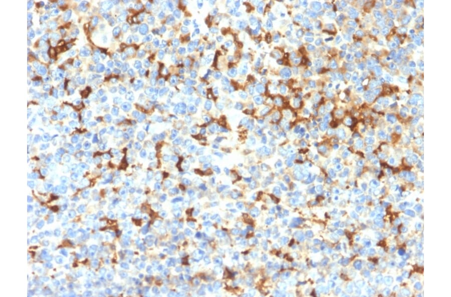 Immunohistochemistry - Anti-TRP1 Antibody [TYRP1/2340R] (A250259) - Antibodies.com