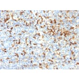 Immunohistochemistry - Anti-TRP1 Antibody [TYRP1/2340R] (A250259) - Antibodies.com