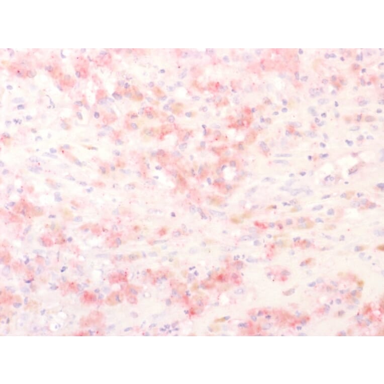 Immunohistochemistry - Anti-TRP1 Antibody [TYRP1/2340R] (A250259) - Antibodies.com